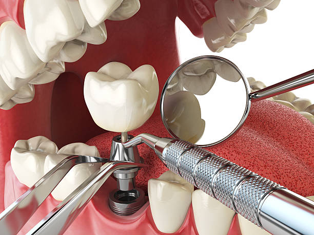Best Emergency Denture Repair in Avondale, AZ
